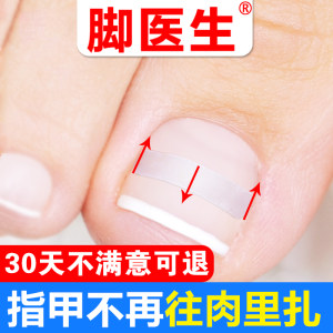 脚医生 甲沟炎甲沟嵌甲矫正贴片